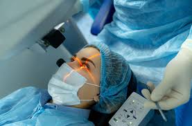 Perfect LASIK